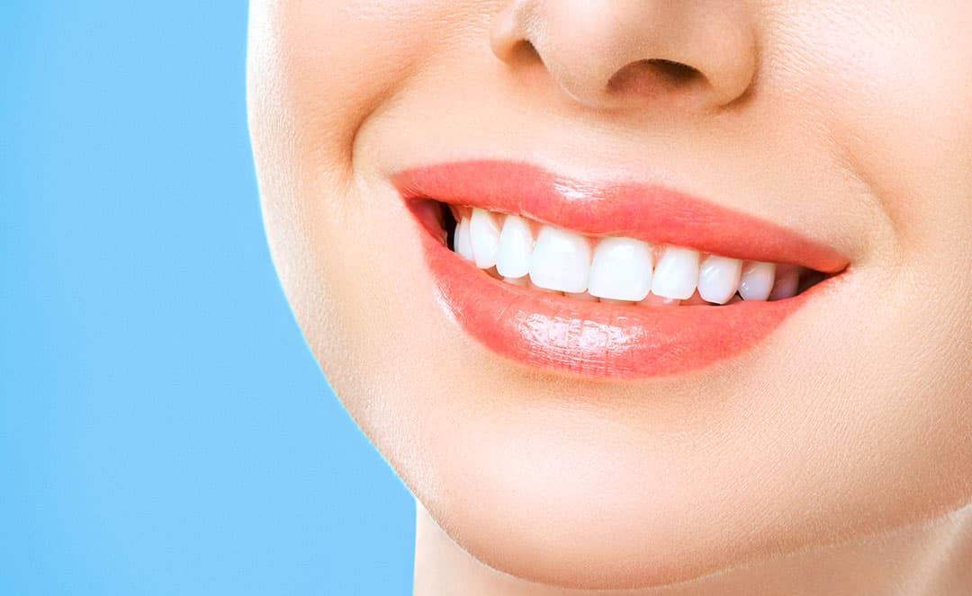 Điều trị bọc răng sứ tại Greenfield Dental